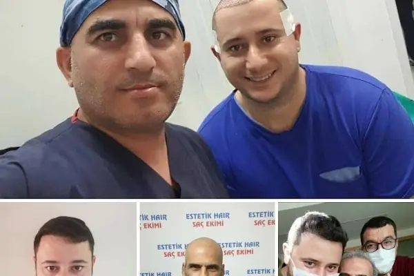 ESTETİK HAİR SAÇ EKİMİ