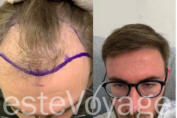 EsteVoyage