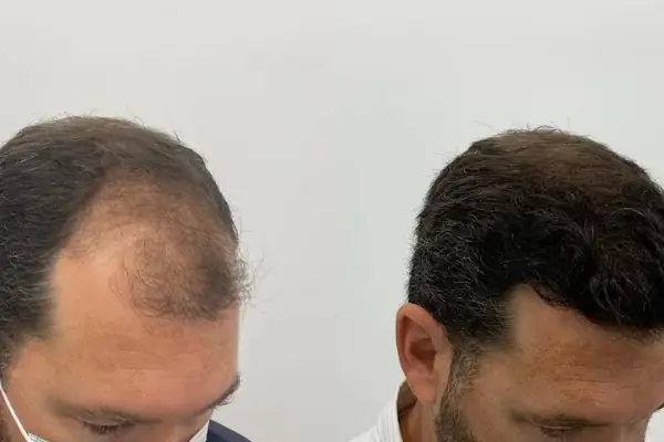 Allina Hair Clinic / Saç Ekimi ve Saç Sorunları Merkezi