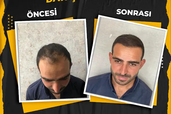 FBK Danışmanlık