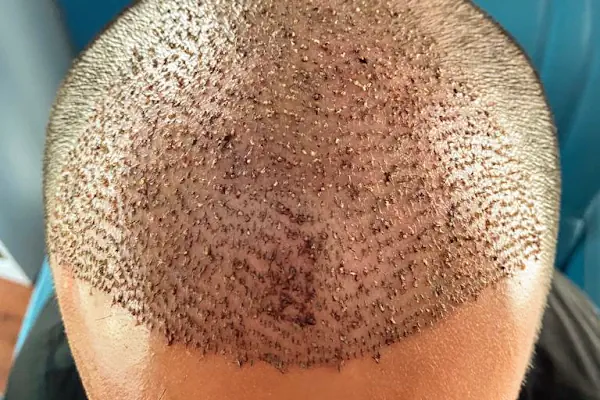 Hollywood Hair Center