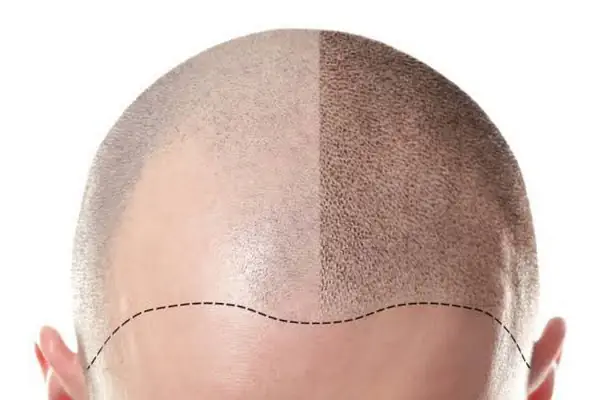 𝐄𝐬𝐭𝐞𝐭𝐢𝐤𝐚𝐁𝐨𝐝𝐫𝐮𝐦