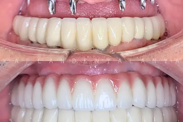 Kaplan DentAlanya Ağız ve Diş Sağlığı Polikliniği