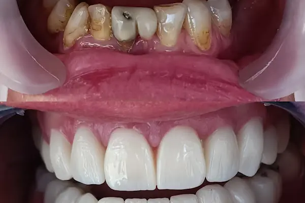 Diş hekimi Mehmet ÖZER-Alanya Diş hekimi -Diş kliniği-İmplant -Zirkonyum-Acil Diş-Kanal Tedavisi-Porselen kaplama-Dentist-