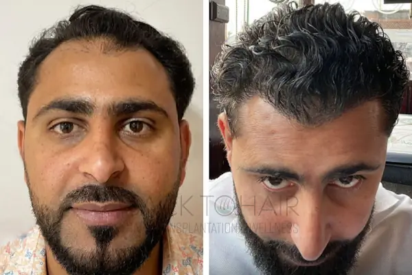 Back to Hair İstanbul