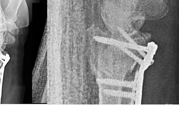 Operatör Doktor Tarık Alphan Ortopedi ve Travmatoloji