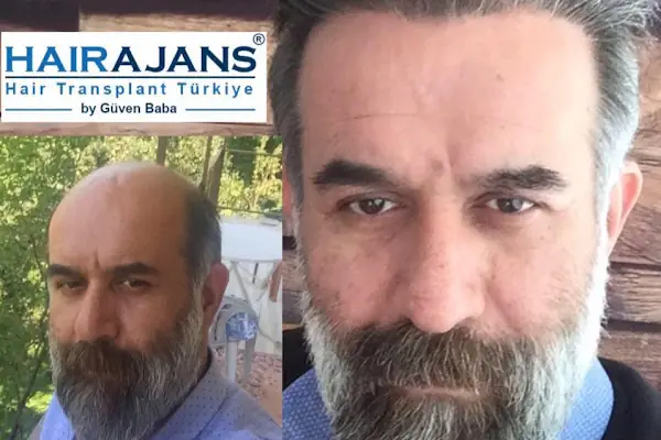 Hair Ajans Saç Ekim Merkezi
