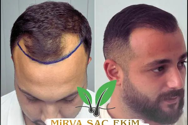 Hifa'M Beauty Center