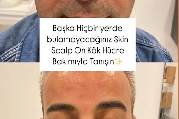 S Clinic Adana - Saç Çoğaltma, Saç Bakım ve Güzellik Merkezi