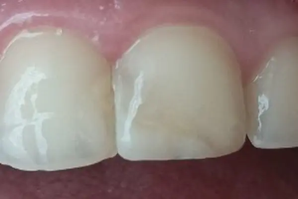 Alyadent Sincan Ağız ve Diş Sağlığı Polikliniği | Sincan