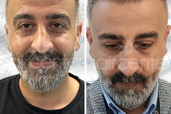 Haircenter Saç Ekim Merkezi