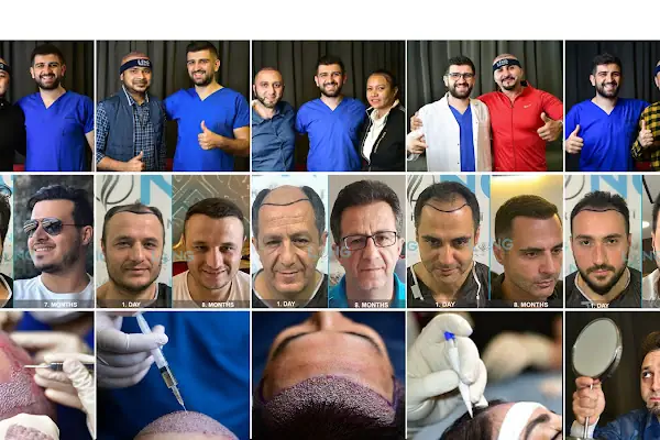 Long Hair Center Istanbul (LHC CLINIC)