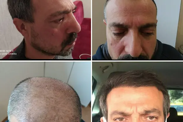 BAC Clinic