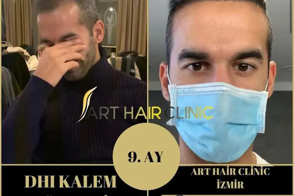 Art Hair Clinic Saç Ekim Merkezi İzmir - En iyi saç ekim merkezi İzmir