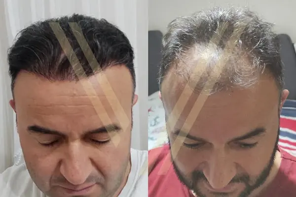Vantage Hair