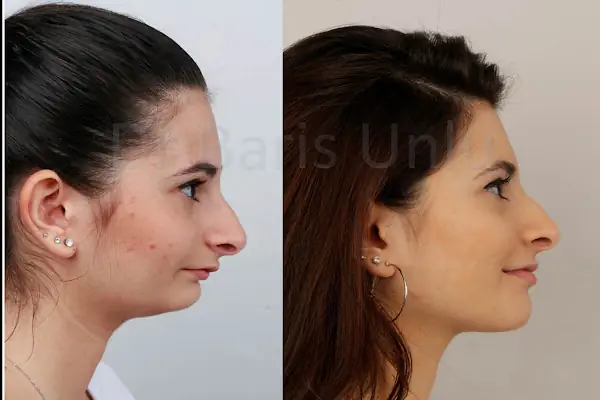 Ortodontist Diş Kliniği