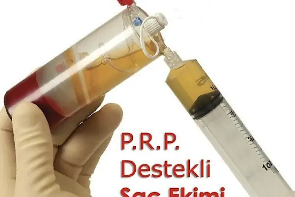 Saç Ekimi(Naturel)