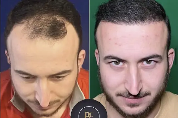 Data Hair Clinic &amp; Eyyüp Tütüncü Saç Ekim Merkezi