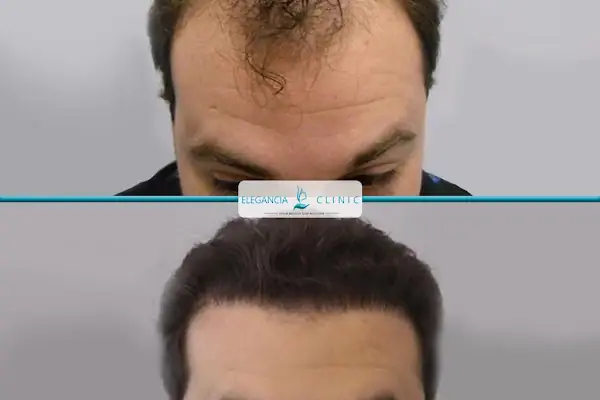 Elegancia Clinic