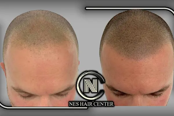 Nes Hair Center